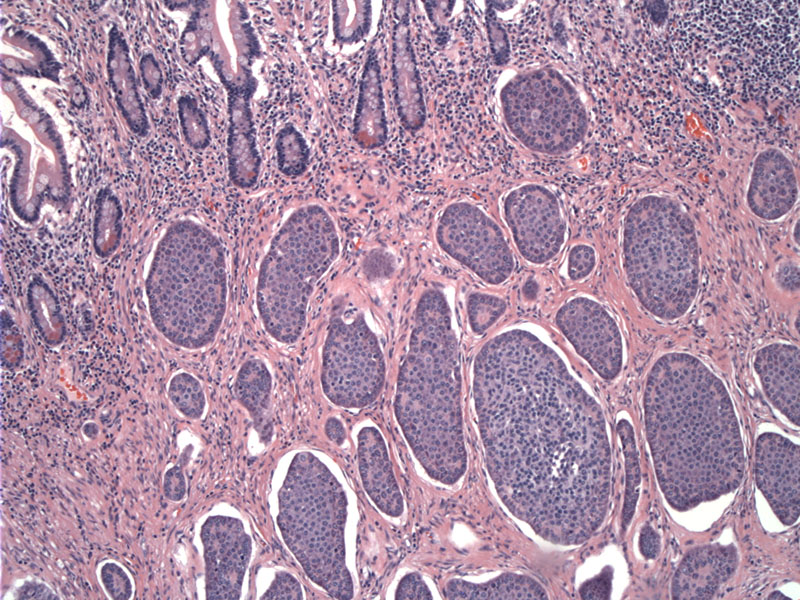 Pathology Image